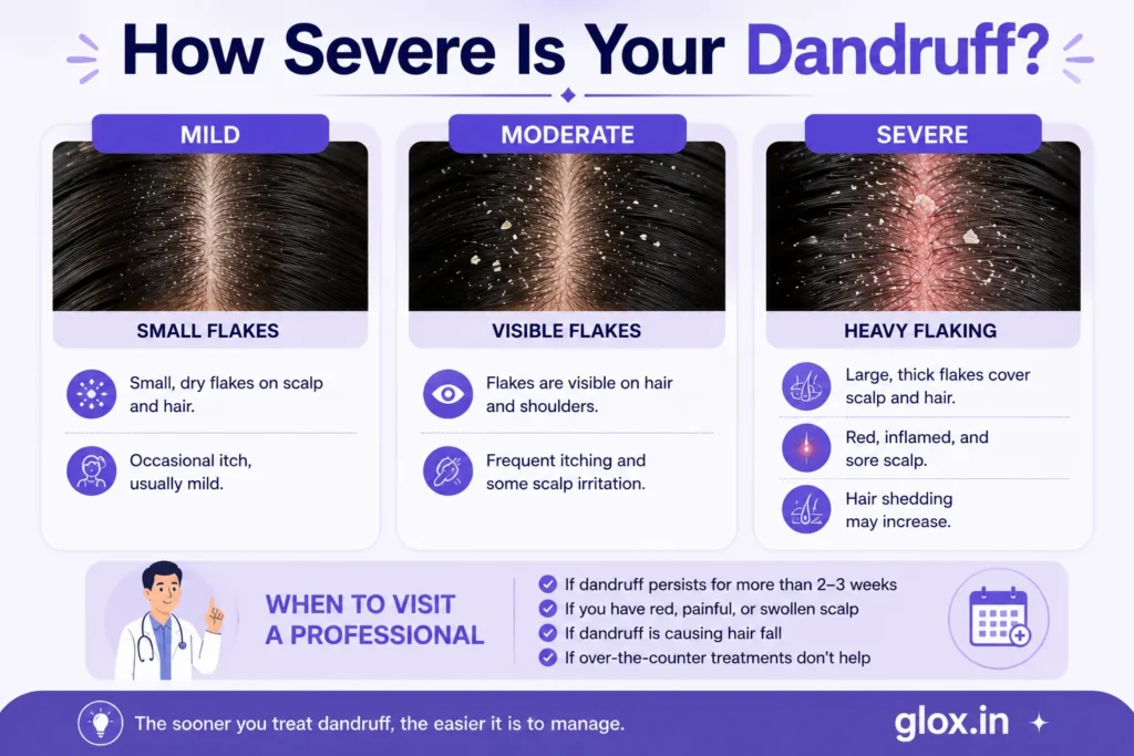 How to Get Rid of Dandruff at Home