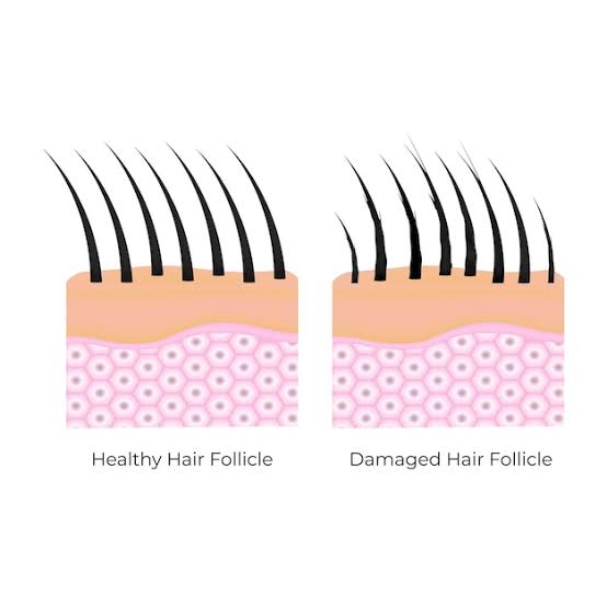 Sulphate Free Shampoo in India